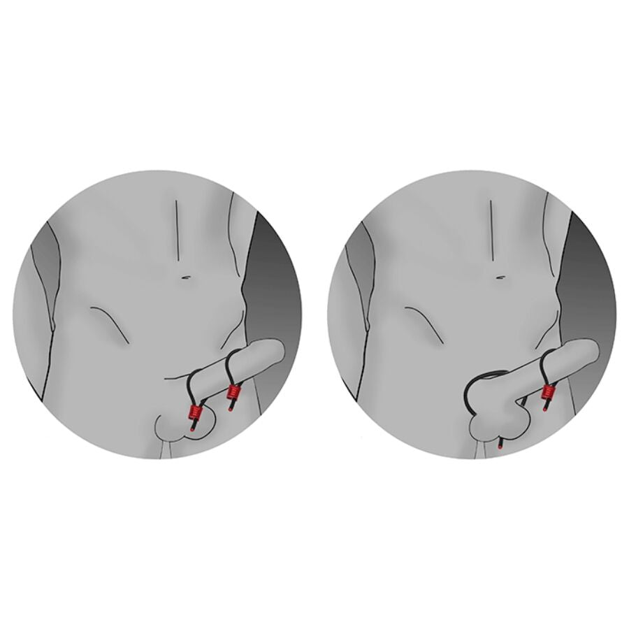 ELECTRASTIM - PRESTIGE ELECTRA LOOPS ADJUSTABLE COCK RINGS BLACK